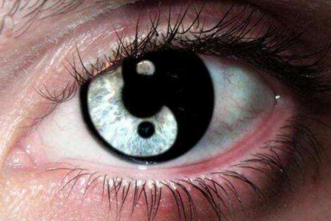 真实人的阴阳眼图片